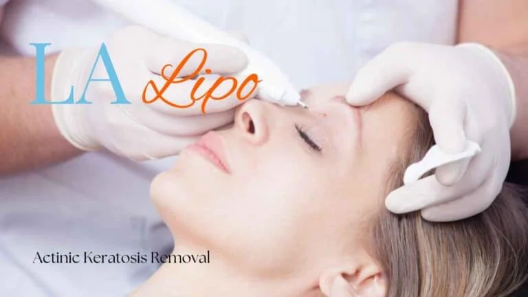 Woman receiving Actinic Keratosis Removal Treatment Scottish