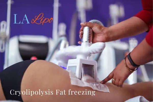 women getting fat freezing Scottish