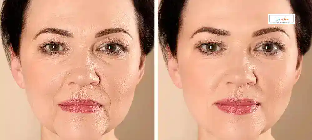 How Long Does It Take to See Results and How Long Do They Last Scottish?