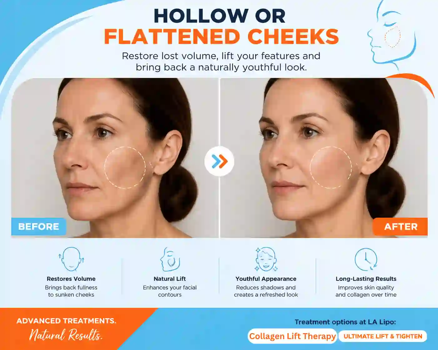 Sign #4: Hollow or Flattened Cheeks Scottish