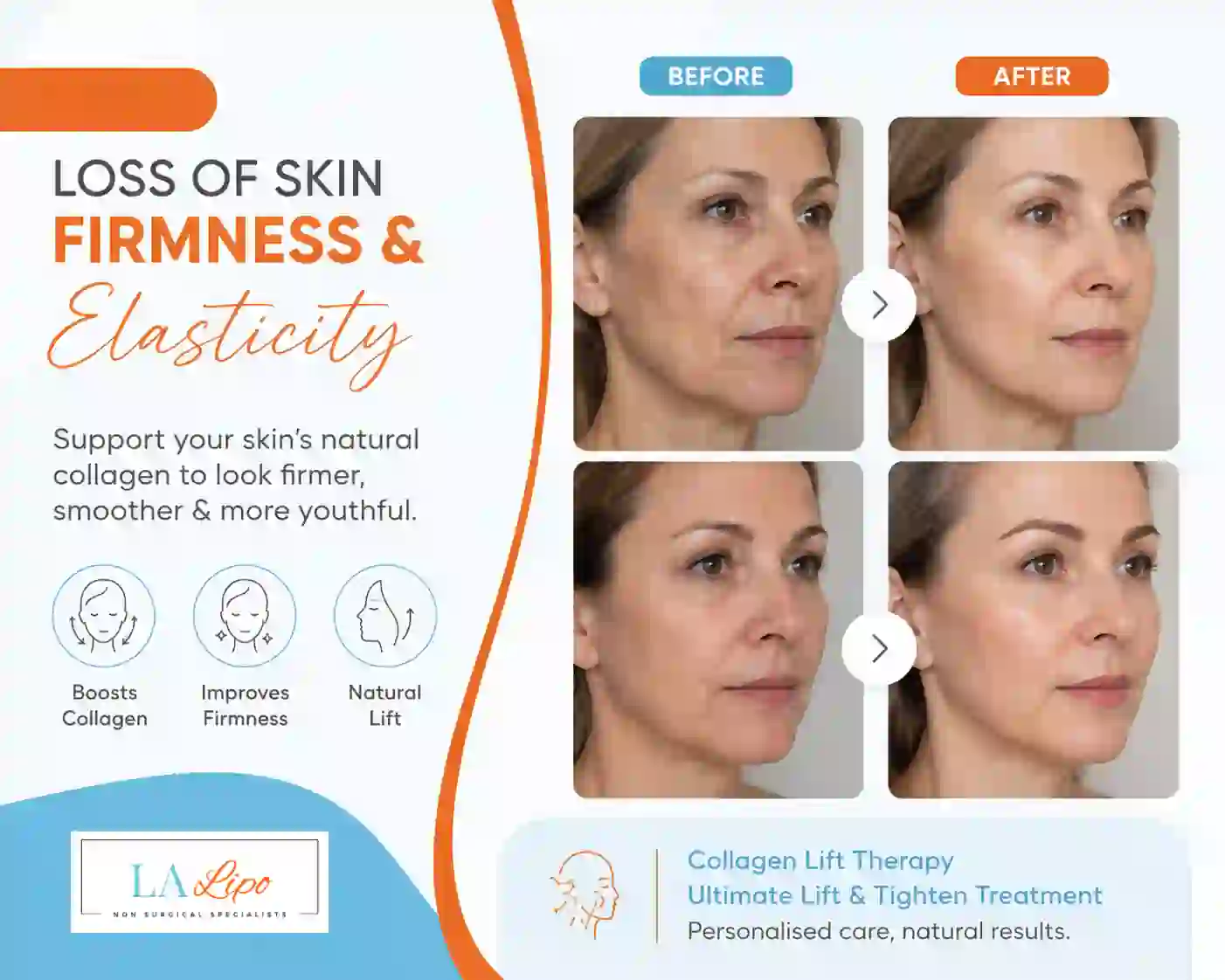 Sign #7: Loss of Skin Firmness and Elasticity Scottish
