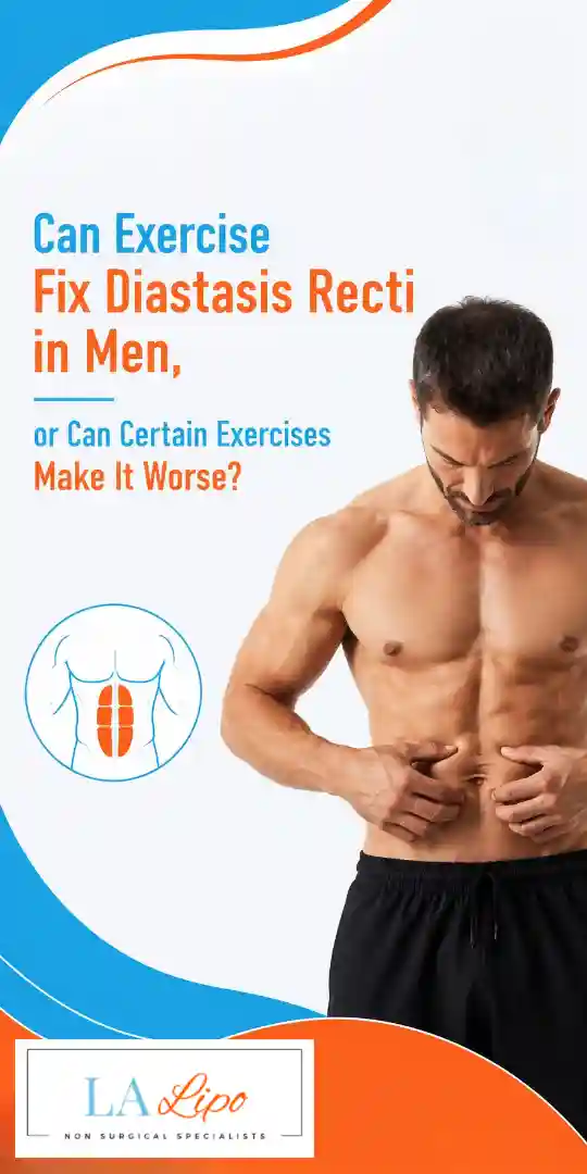 Can Exercise Fix Diastasis Recti in Men, or Can Certain Exercises Make It Worse Scottish?
